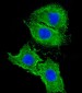 AGTR1 Antibody (Center)